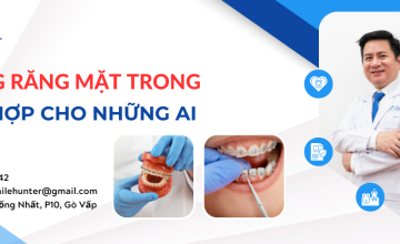 NIỀNG RĂNG MẶT TRONG PHÙ HỢP CHO NHỮNG AI