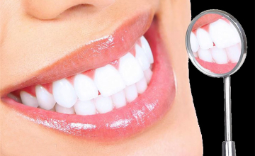 [Ưu đãi sốc] Tẩy trắng răng giảm ngay 300K – Cơ hội sở hữu nụ cười rạng rỡ chưa bao giờ dễ dàng hơn!