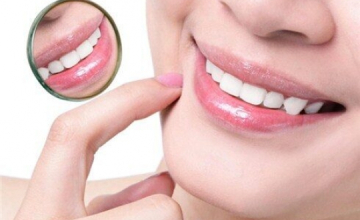 Tẩy Trắng Răng Ảnh Hưởng Như Thế Nào Đến Men Răng Và Mô Nướu? Sự Thật Khoa Học Bạn Cần Biết